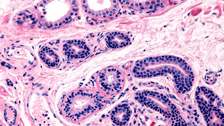 Microscopic view of secretory units of apocrine and eccrine sweat glands